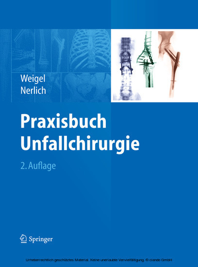 Praxisbuch Unfallchirurgie