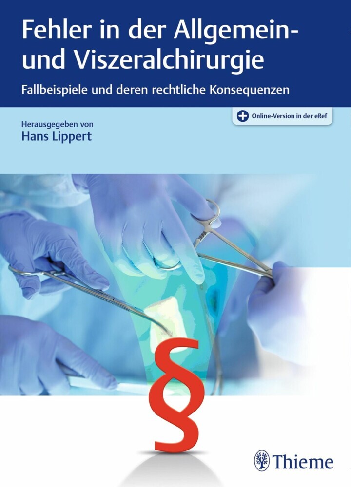 Fehler in der Allgemein- und Viszeralchirurgie