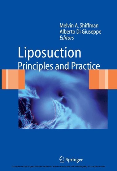 Liposuction