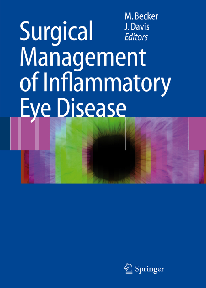 Surgical Management of Inflammatory Eye Disease