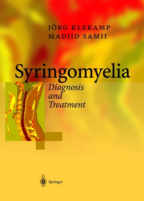 Syringomyelia