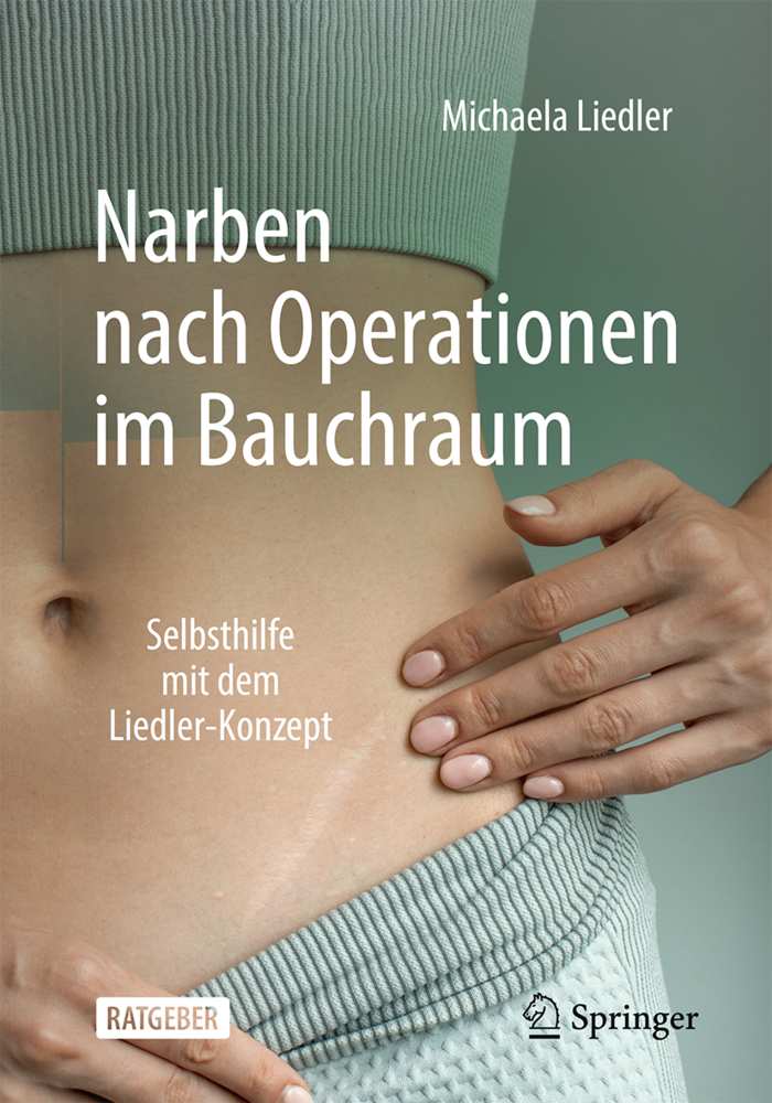 Narben nach Operationen im Bauchraum