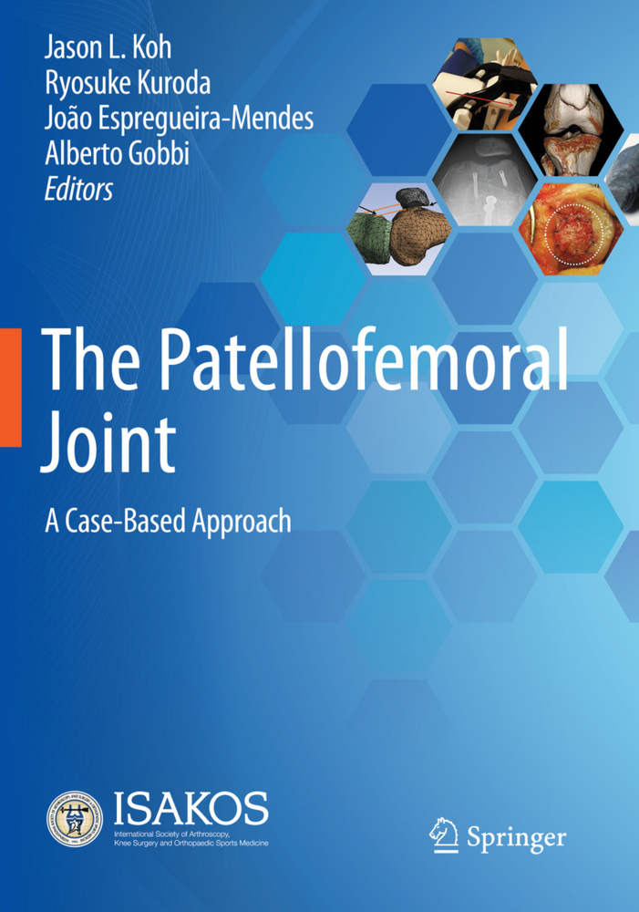 The Patellofemoral Joint