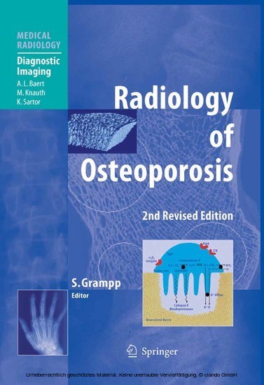 Radiology of Osteoporosis