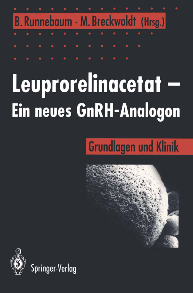 Leuprorelinacetat - Ein neues GnRH-Analogon