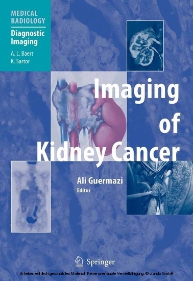 Imaging of Kidney Cancer