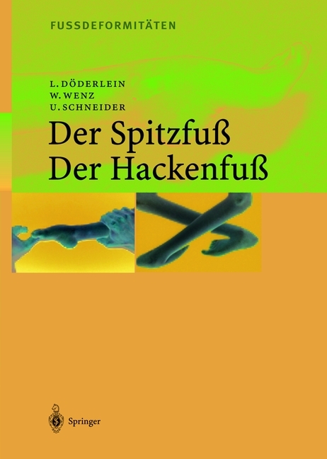 Fussdeformitäten