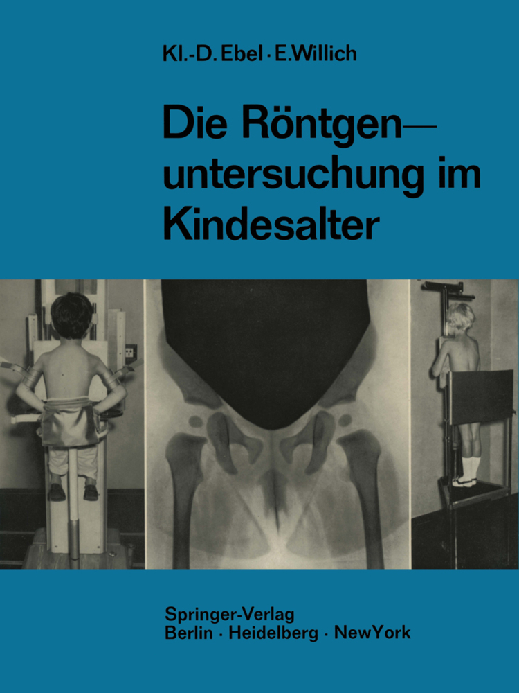 Die Röntgenuntersuchung im Kindesalter