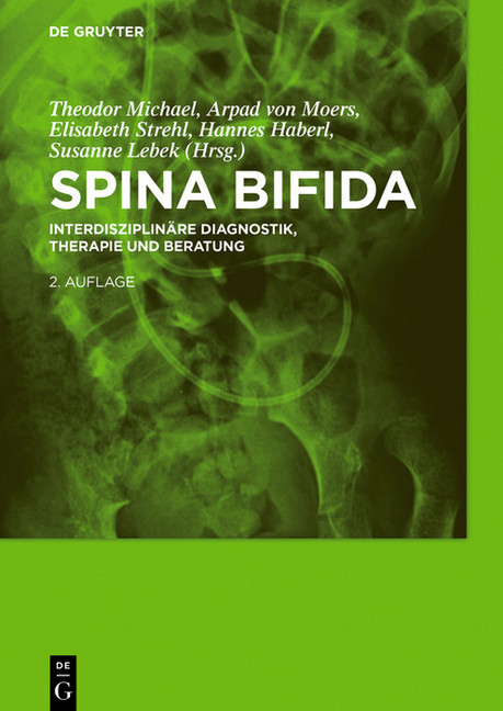 Spina bifida