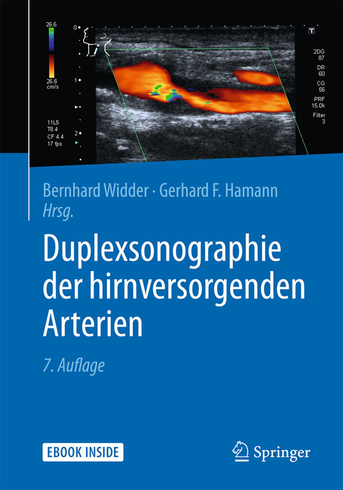 Duplexsonographie der hirnversorgenden Arterien, m. 1 Buch, m. 1 E-Book