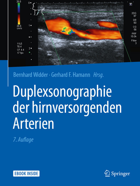 Duplexsonographie der hirnversorgenden Arterien