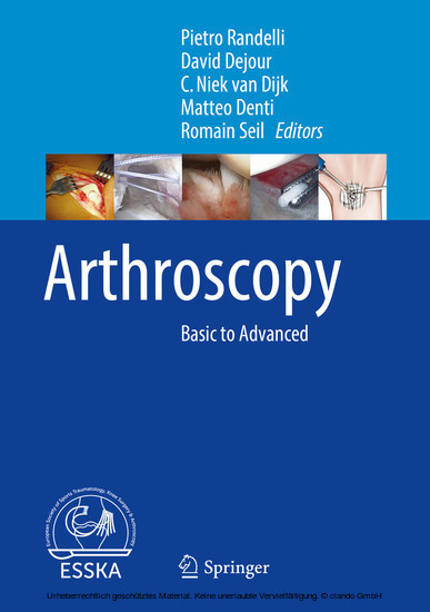 Arthroscopy