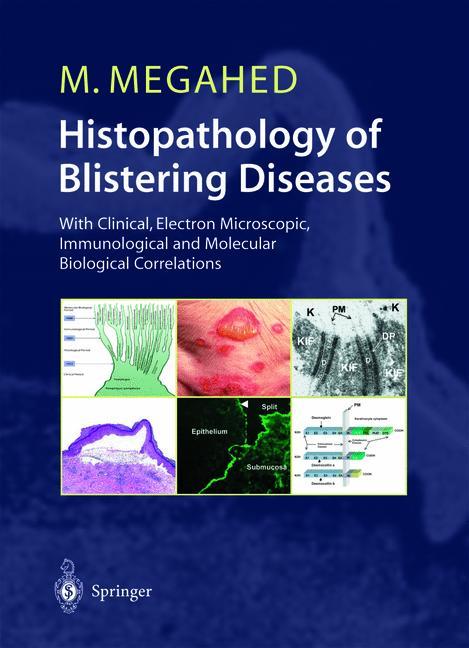 Histopathology of Blistering Diseases