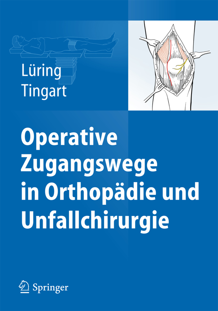 Operative Zugangswege in Orthopädie und Unfallchrirugie
