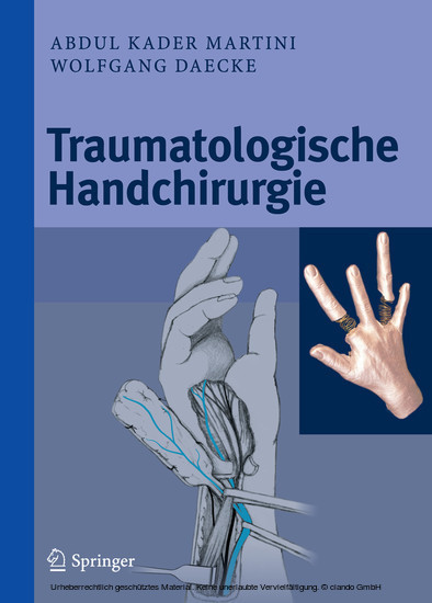 Traumatologische Handchirurgie