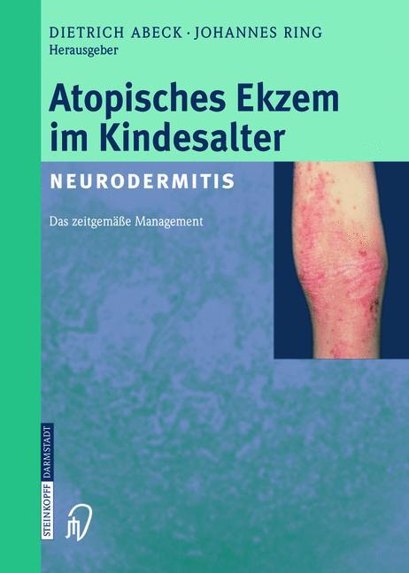 Atopisches Ekzem im Kindesalter (Neurodermitis)