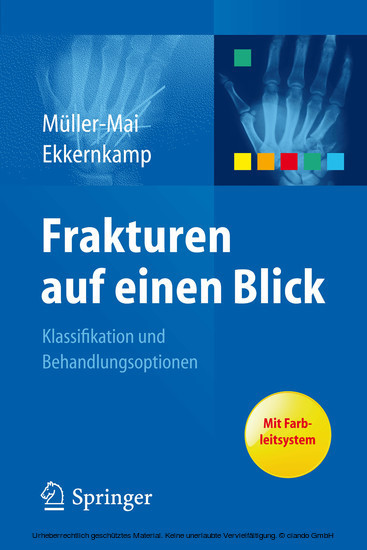 Frakturen auf einen Blick