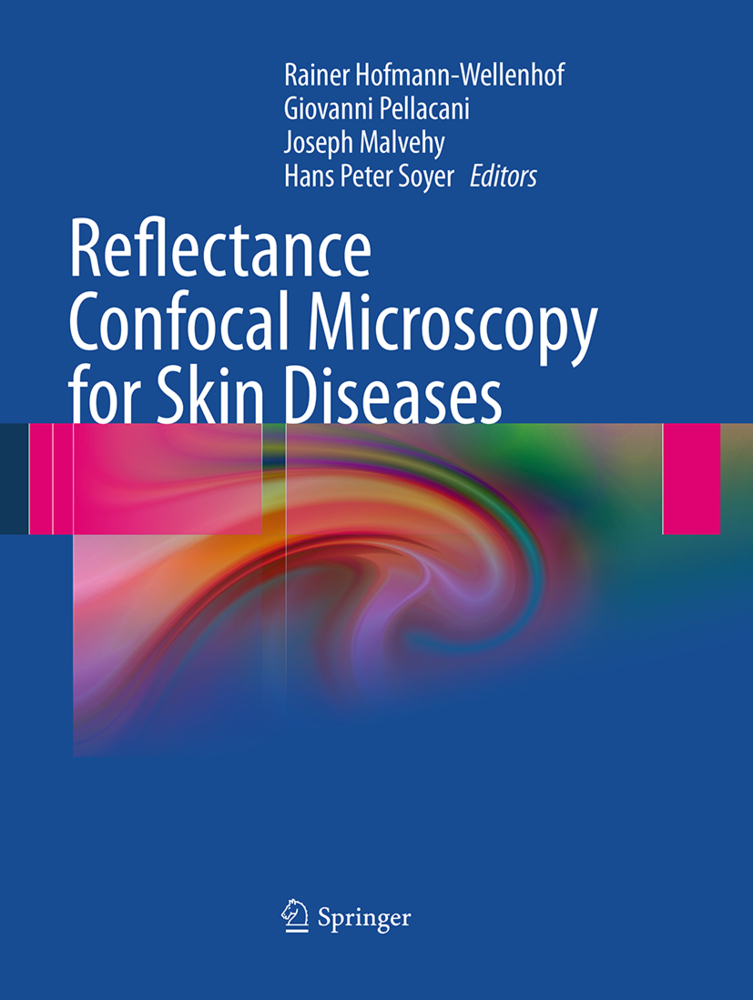 Reflectance Confocal Microscopy for Skin Diseases