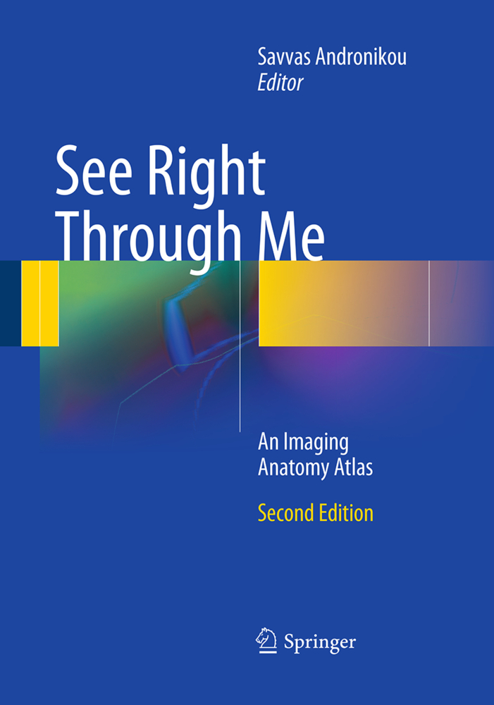 See Right Through Me