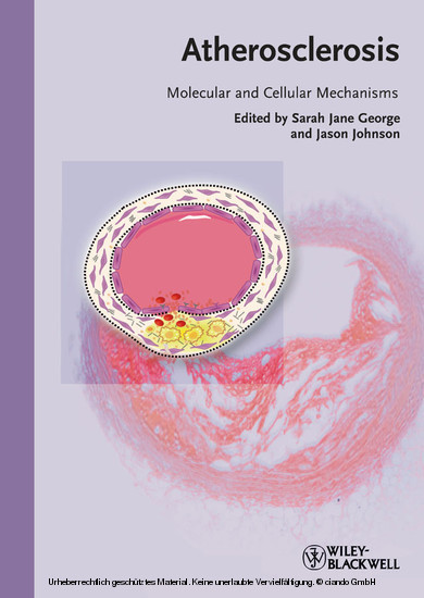 Atherosclerosis