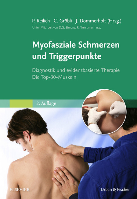 Myofasziale Schmerzen und Triggerpunkte