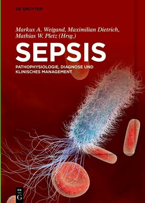 Sepsis