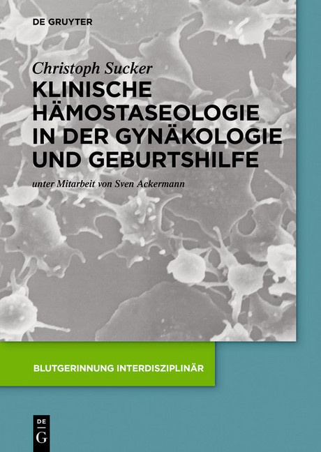 Klinische Hämostaseologie in der Gynäkologie und Geburtshilfe