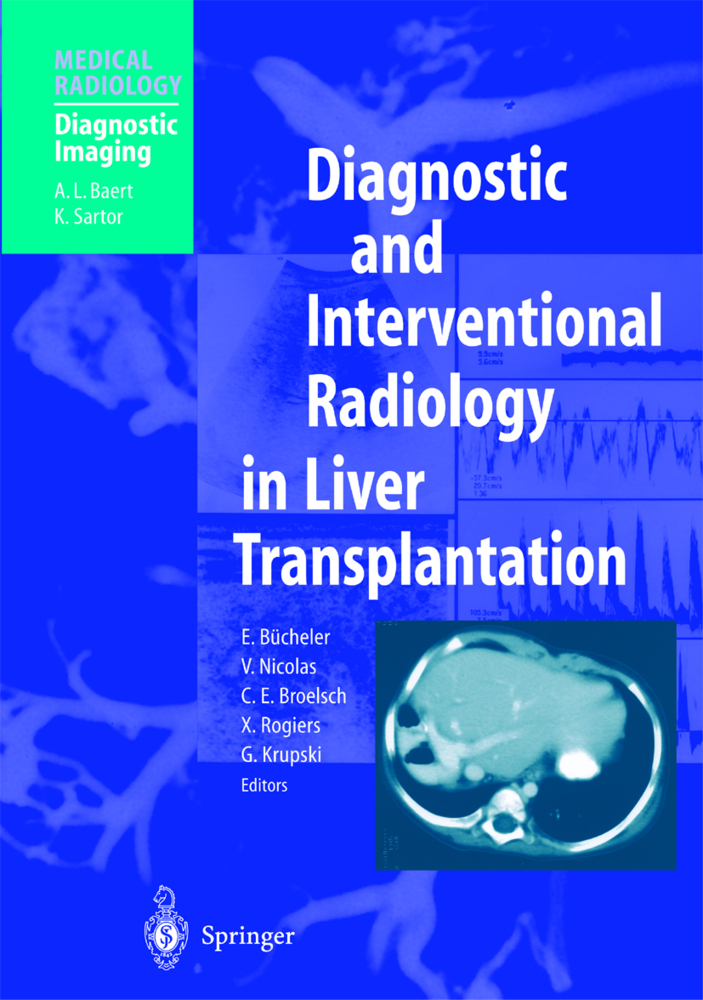 Diagnostic and Interventional Radiology in Liver Transplantation