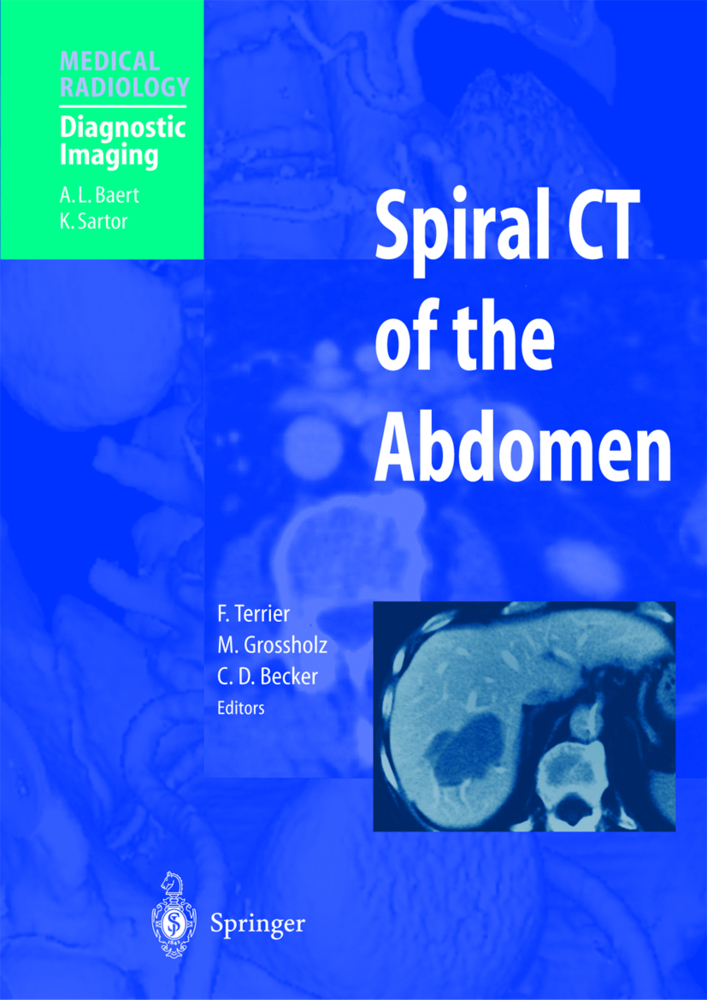 Spiral CT of the Abdomen