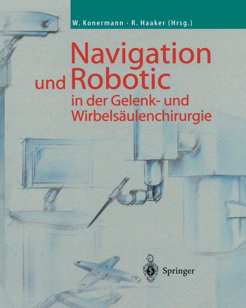 Navigation und Robotic in der Gelenk- und Wirbelsäulenchirurgie